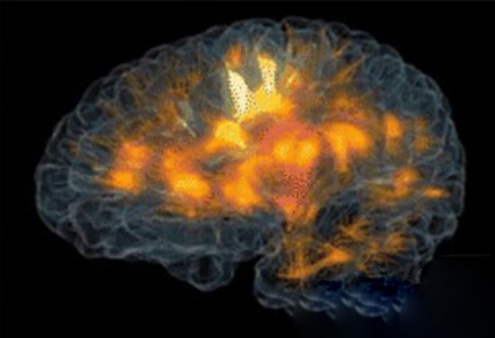 成像技术观察大脑活动 全新的体验病人的福音