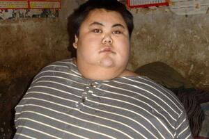中国第一胖离世，孙亮（600斤）因心肺衰竭离世