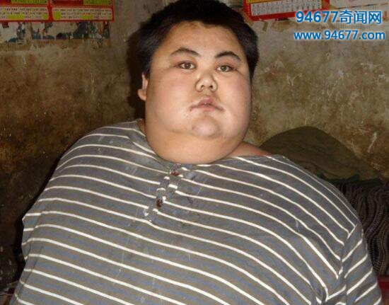 中国第一胖离世，孙亮（600斤）因心肺衰竭离世