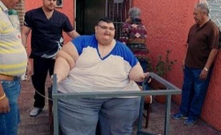 世界上减肥最多的人，胡安三年减了660斤，接下来还要继续手术切除190斤