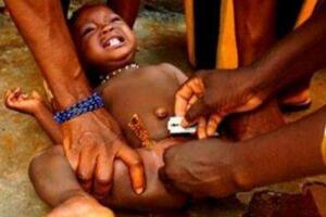 实拍非洲女孩割礼全过程，割除女性外阴供男人玩弄