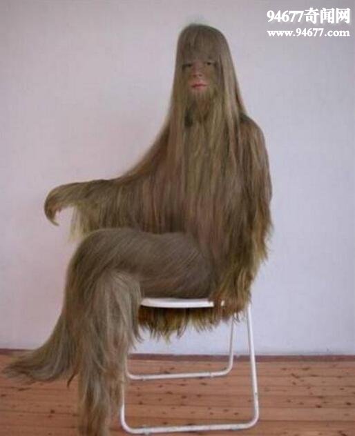 世界上体毛最长的人，艾米丽·苏珊(返祖猿人)