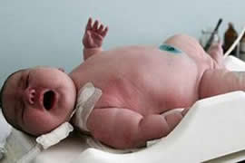 世界上最大的婴儿，出生既37斤(等同于6岁孩子体重)