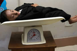 世界上体重最轻的人，18岁少年体重仅11斤(图)