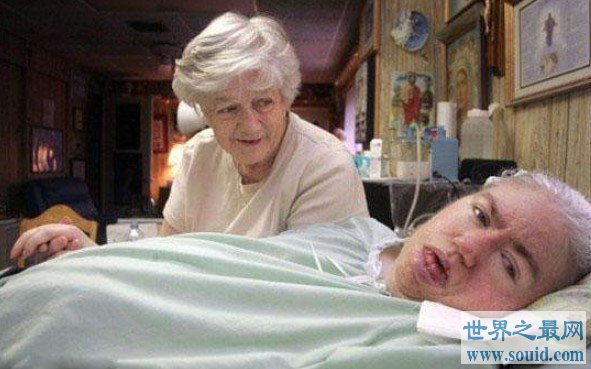 世界上昏迷时间最长的人，整整是昏迷了42年(www.gifqq.com)