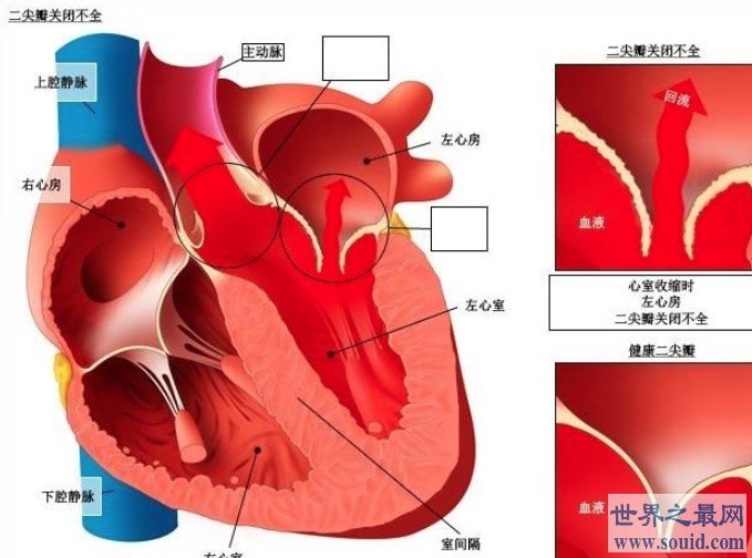 最强3D打印技术，首次制造“迷你人类心脏”(www.gifqq.com)