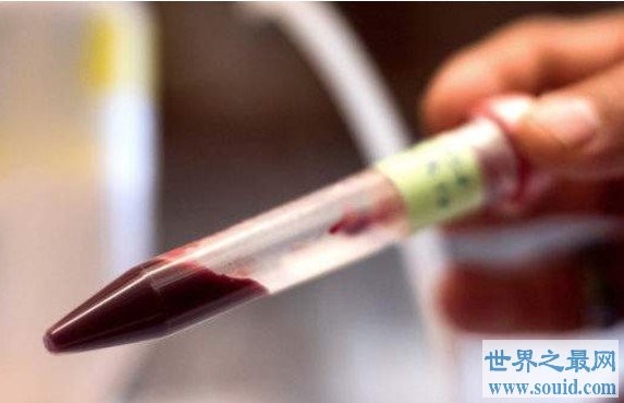 世界第一款人造血液来袭，适合任何血型，可保存一年以上