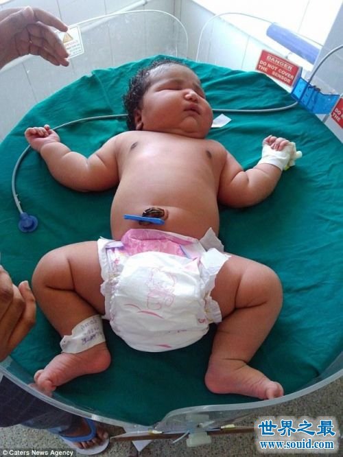 世界上最重的女婴，印度19岁女孩生13.6斤重巨婴(www.gifqq.com)