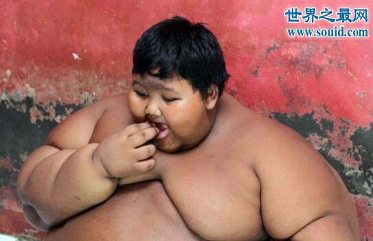 世界上最胖的男孩，印尼男孩年仅10岁重达384斤(www.gifqq.com)