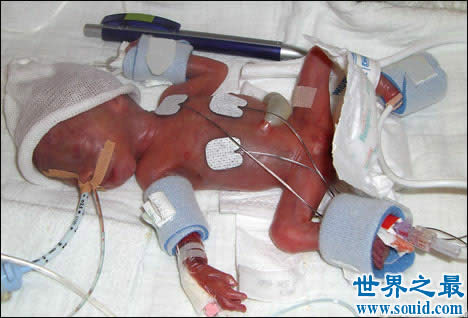 世界上最大的婴儿，出生既37斤(等同于6岁孩子体重)(www.gifqq.com)