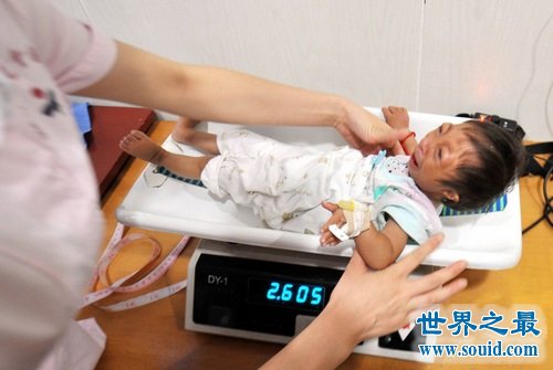 中国女童身高只有54厘米，可能是世界上最矮的人(www.gifqq.com)