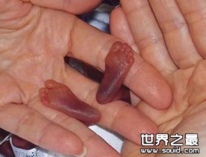 世界上最小的婴儿(www.gifqq.com)