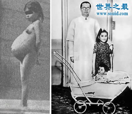 世界上最大的婴儿，出生既37斤(等同于6岁孩子体重)(www.gifqq.com)