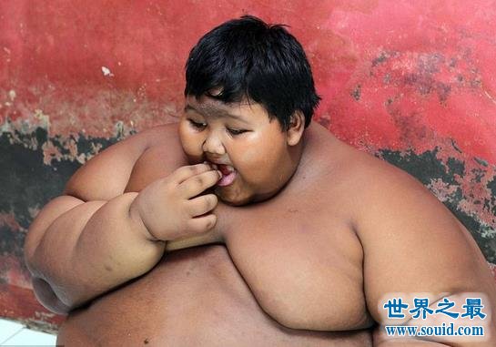 世界上最胖的孩子，10岁体重既达到384斤(www.gifqq.com)