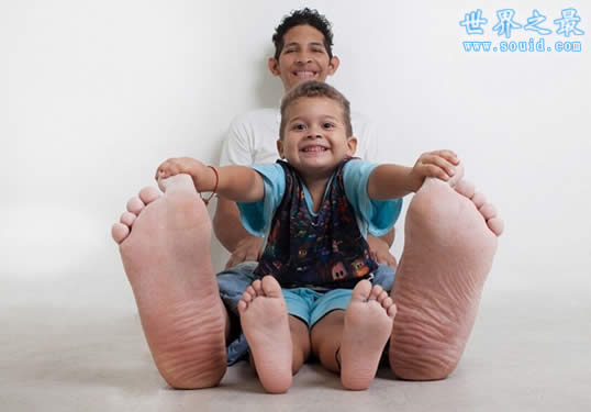 世界上最大的脚，长达0.4米(比小孩还高)(www.gifqq.com)