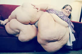 世界第一胖人，苏珊娜.埃曼重达1450斤(图片)