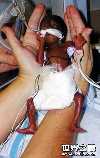 世界上最小的婴儿(www.gifqq.com)