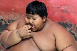 世界上最胖的男孩，印尼男孩年仅10岁重达384斤