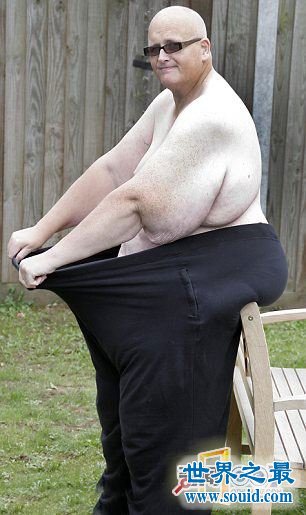 世界上最胖的人减掉500斤肉，皮肤下垂吓死人(www.gifqq.com)
