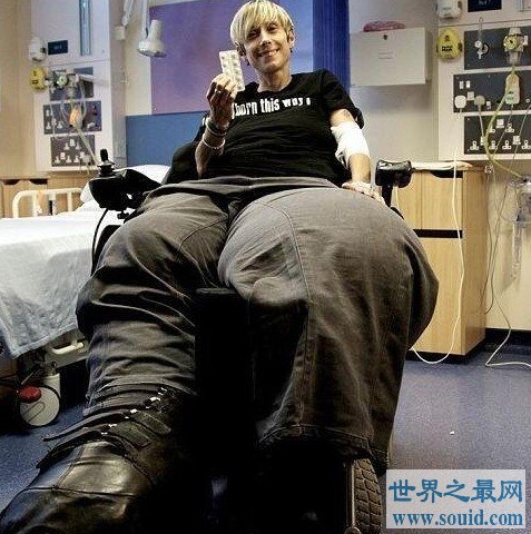 世界上最大最粗的腿，两腿达到了108公斤(www.gifqq.com)