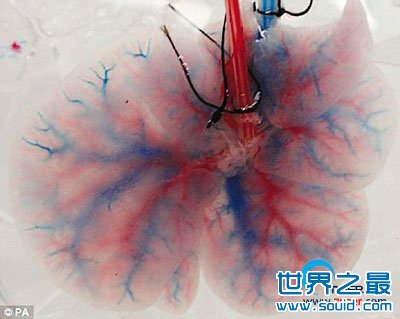 世界上第一个人造肝脏(www.gifqq.com)