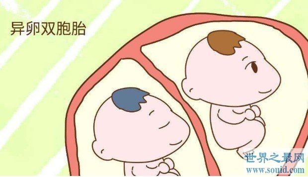 世界首对同母异父双胞胎，2颗卵子同时着床(www.gifqq.com)