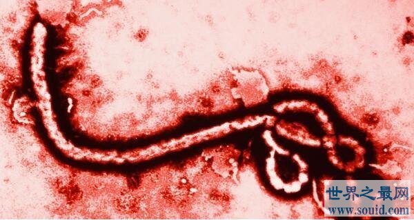世界上10大最恐怖的病毒，第一让近数亿人死亡，艾滋病仅第五(www.gifqq.com)