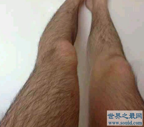 世界上最长的腿毛，其腿毛长到了22.46厘米(www.gifqq.com)
