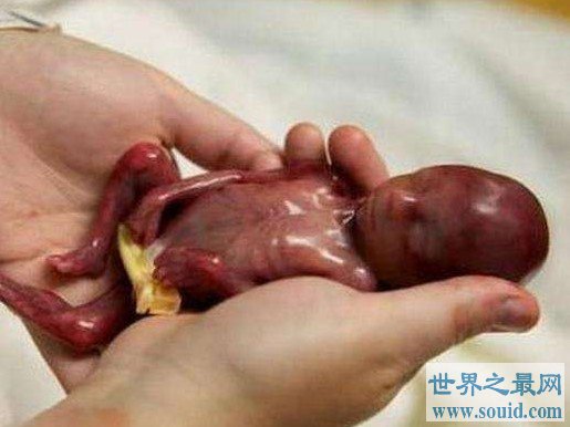 世界上最小的婴儿，还没有一支笔大