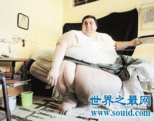 世界最胖男人重大800多斤 疾病缠身 日常生活非常不方便