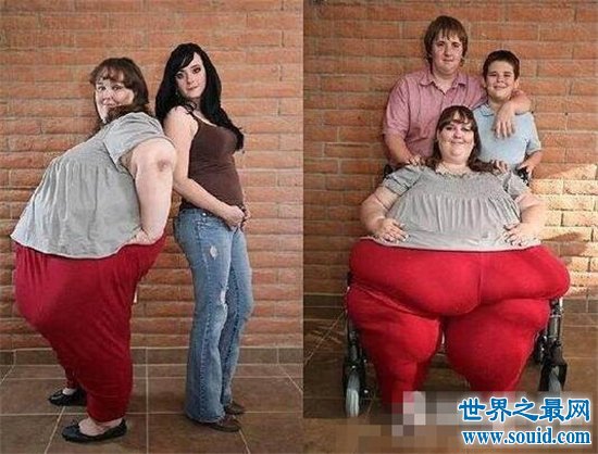 世界上最胖的人具有725公斤，生活上造成很大的不便(www.gifqq.com)