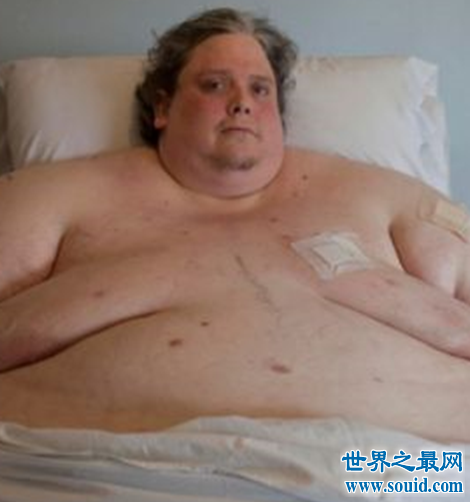 八个世界上最胖的人，这些人胖的无法自理。(www.gifqq.com)