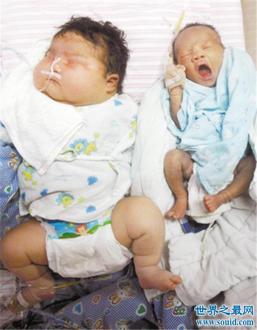 最重的婴儿，相当于几岁小孩的体重(www.gifqq.com)