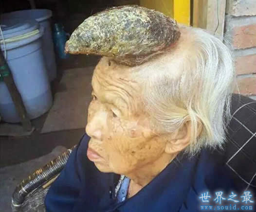 中国87岁老太头上长出牛角，太恐怖(www.gifqq.com)